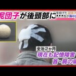 マンション上層から｢泥団子｣投げた小学生を児童相談所に通告 頭に直撃した男性は今も記憶障害…