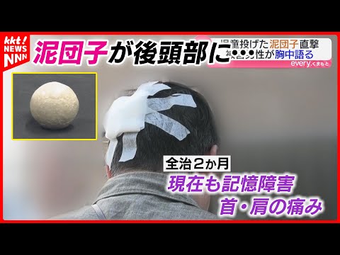 マンション上層から「泥団子」投げた小学生を児童相談所に通告 頭に直撃した男性は今も記憶障害…