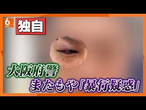 【独自】またもや大阪府警に「家宅捜索中に暴行」疑惑　“事件と無関係”男性が「捜査4課員に顔をひざ蹴りされた」　全治1カ月のけがで刑事告訴、府警が受理し捜査へ