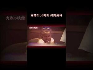 たった1本の抜歯のはずが… #事件 #実話犯罪