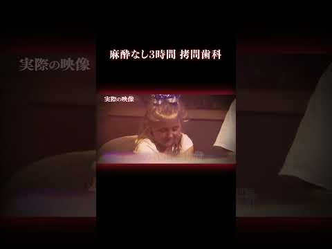 たった1本の抜歯のはずが… #事件 #実話犯罪