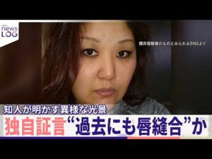 【独自証言】「自ら唇を縫っていた」同居女性傷害事件、知人が明かす異様な光景 50歳女は関与否定【news LOG】