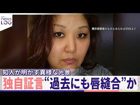 【独自証言】「自ら唇を縫っていた」同居女性傷害事件、知人が明かす異様な光景 50歳女は関与否定【news LOG】