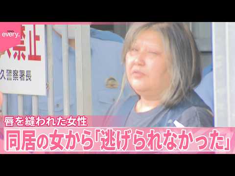 【唇を縫われた女性】紙に｢助けて｣の文字  同居の49歳女逮捕  ｢怖くて逃げられなかった｣監禁事件の可能性も