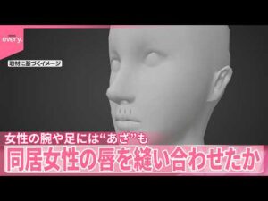 【事件】鼻下あたりから下唇にかけ複数回…同居女性の唇を“裁縫用の糸”で縫い合わせたか　女性の腕や足には“あざ”も  逮捕の女は容疑否認