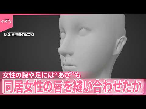 【事件】鼻下あたりから下唇にかけ複数回…同居女性の唇を“裁縫用の糸”で縫い合わせたか　女性の腕や足には“あざ”も  逮捕の女は容疑否認
